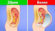 8 признака на чернодробно заболяване, които показват, че трябва да посетите лекар веднага