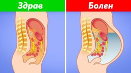 8 признака на чернодробно заболяване, които показват, че трябва да посетите лекар веднага